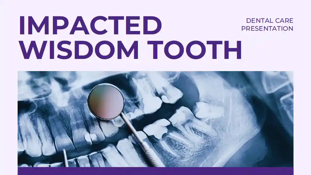 Impacted Wisdom Teeth Slides